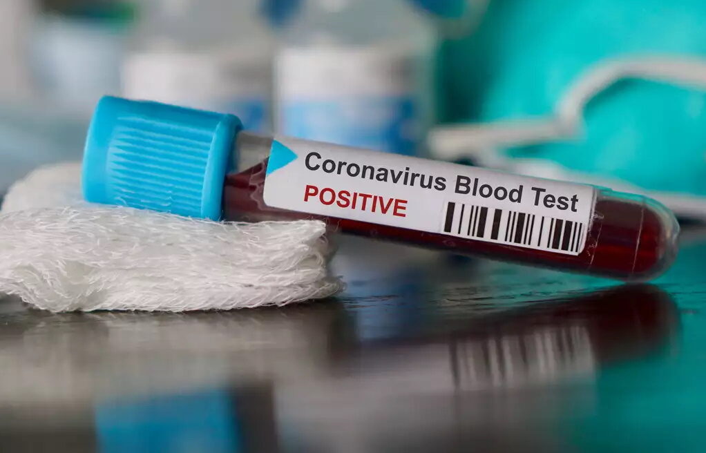 Κορονοϊός: Μπορεί η ομάδα αίματος να μειώσει τον κίνδυνο να νοσήσει κάποιος;