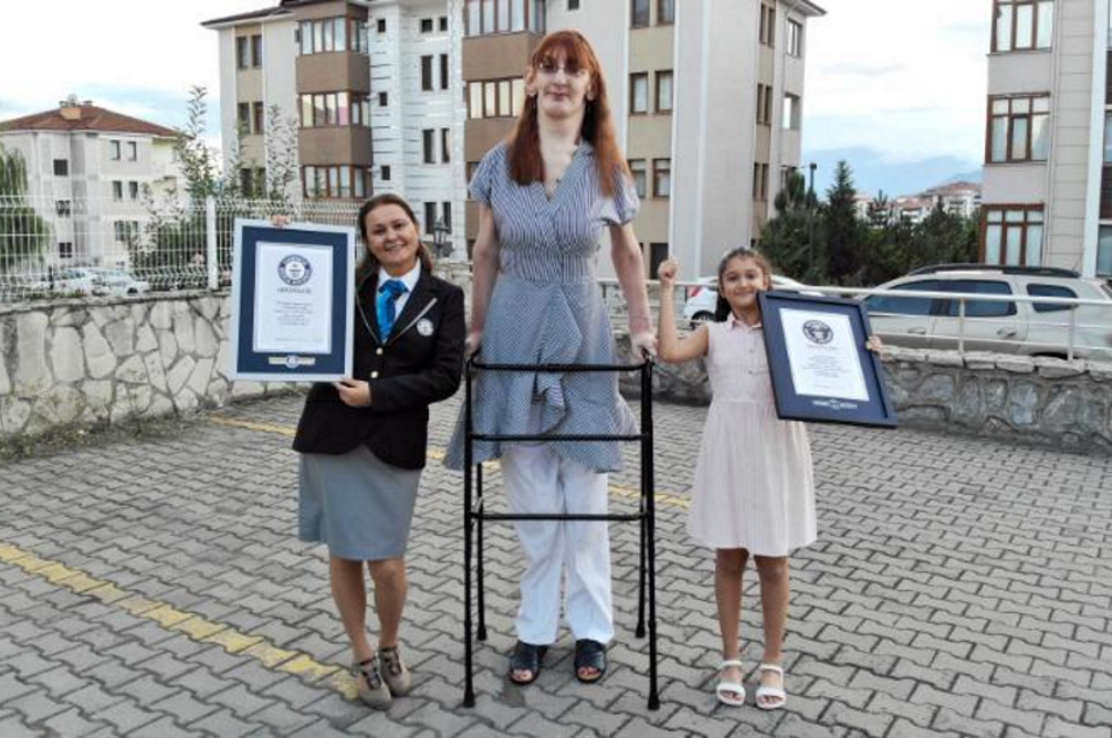 Η ψηλότερη γυναίκα στον κόσμο είναι από την Τουρκία και δηλώνει: «Είναι εντάξει να ξεχωρίζει κανείς»