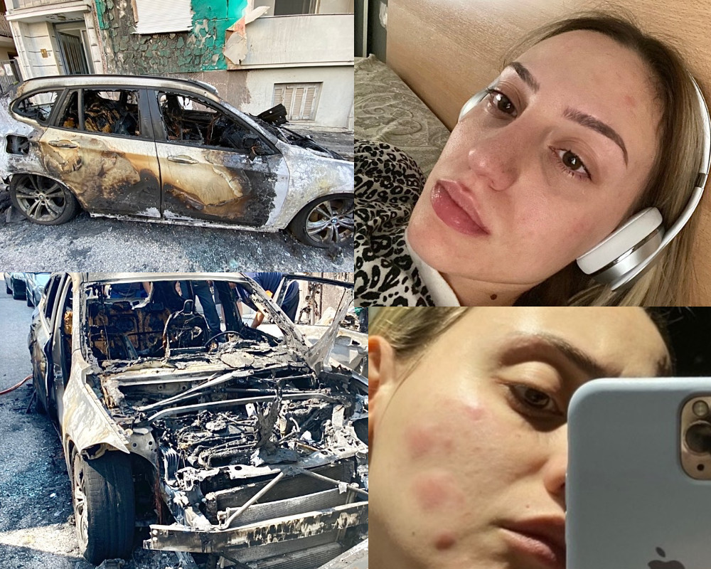 Άννα Κορακάκη: Η συνταρακτική ανάρτησή της μετά την καταδίκη του επικίνδυνου stalker της – «Παλεύω με μετατραυματικό στρες και ψυχοσωματικά νοσήματα»